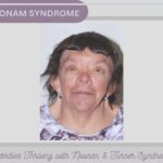 celebrities with noonan syndrome