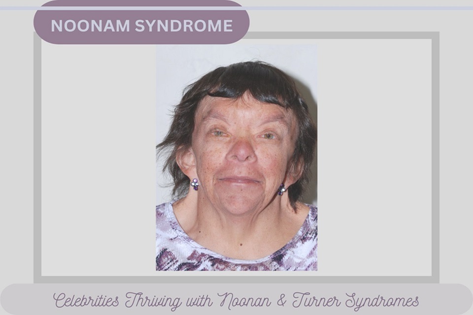 celebrities with noonan syndrome